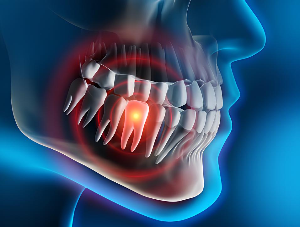 Teeth image - Emergency dentist Scunthorpe